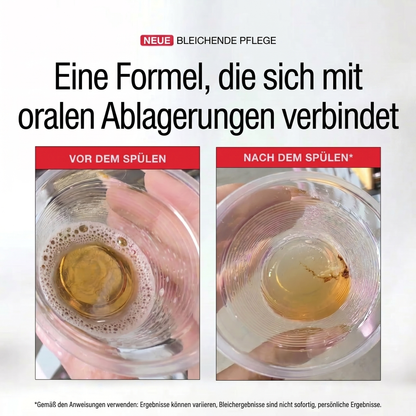 Aufhellendes Anti-Flecken-Mundwasser 237 ml.